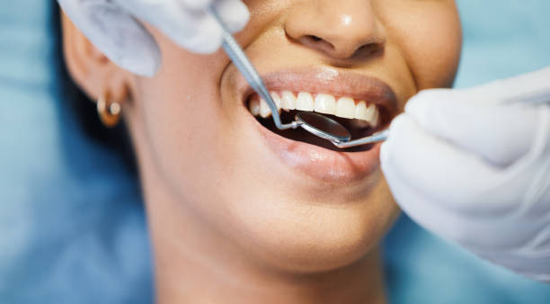 Best Emergency Wisdom Teeth Removal in Harriman, TN